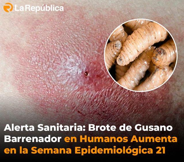 Alerta Sanitaria: Brote de Gusano Barrenador en Humanos Aumenta en la Semana Epidemiológica 21 - Cover Image